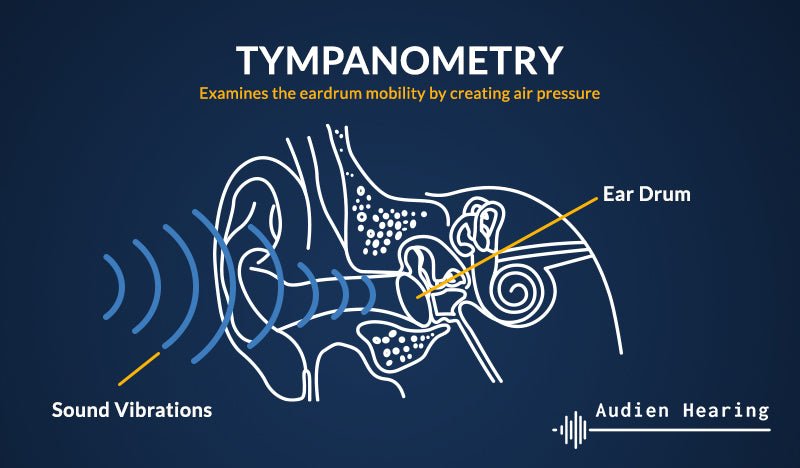 What is tympanometry?
